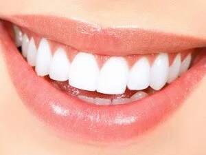 Teeth-Whitening Miracle Review - Lourdes - 1066