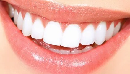 Teeth-Whitening Miracle Review - Lourdes - 1066